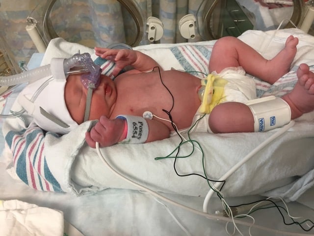 PALS Pediatric Advanced Life Support